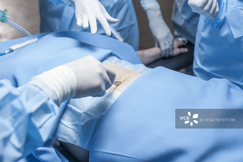 外科手术团队为病人进行手术图片素材
