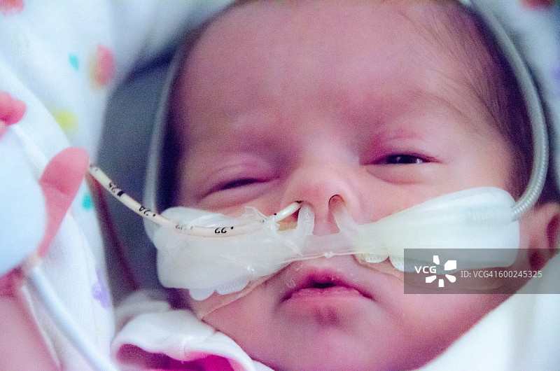 带着鼻胃管和氧气面罩的新生儿图片素材