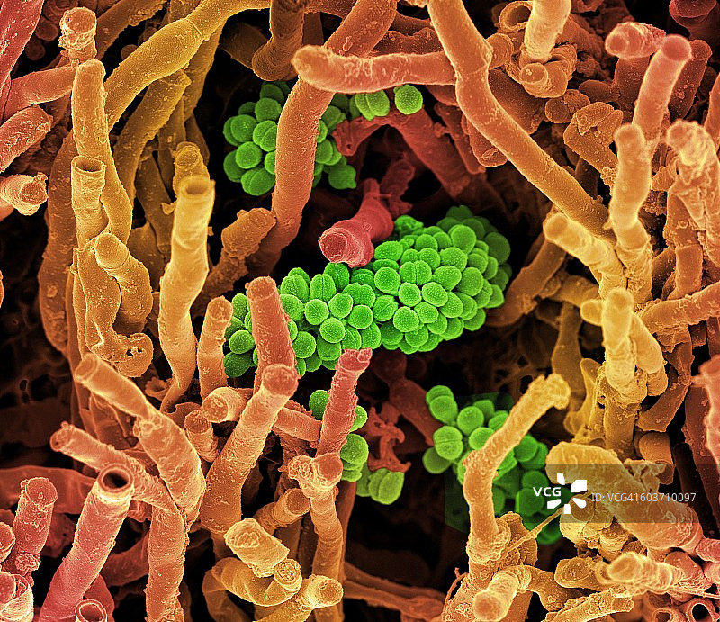天蓝色链霉菌，扫描电镜图片素材