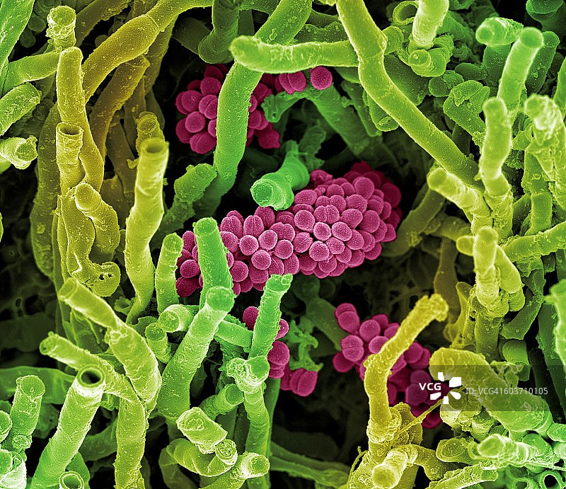 天蓝色链霉菌，扫描电镜图片素材