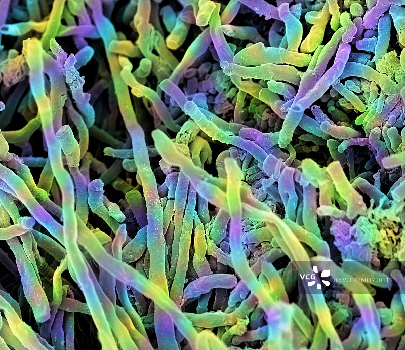 天蓝色链霉菌，扫描电镜图片素材