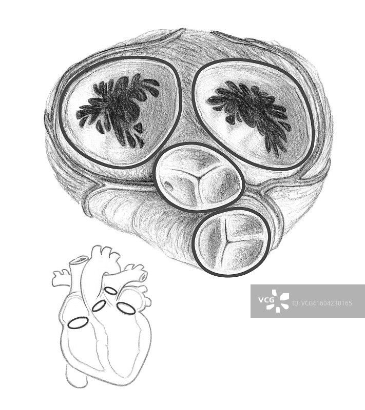 心脏瓣膜顶视图及正面嵌入图图片素材