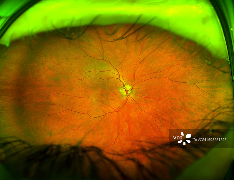 视网膜激光眼部扫描图像图片素材
