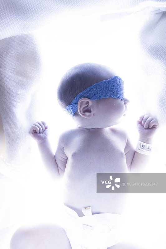 用于治疗黄疸的蓝色光照中的婴儿图片素材