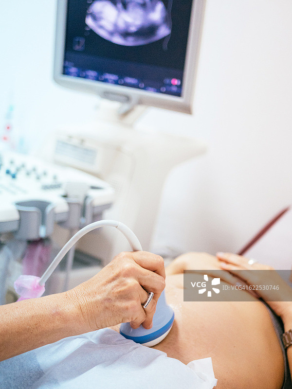 4D彩超产前检查图片素材