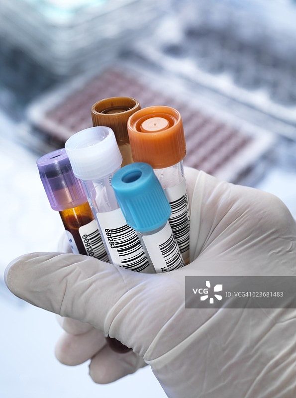 血液及其他检测样本图片素材