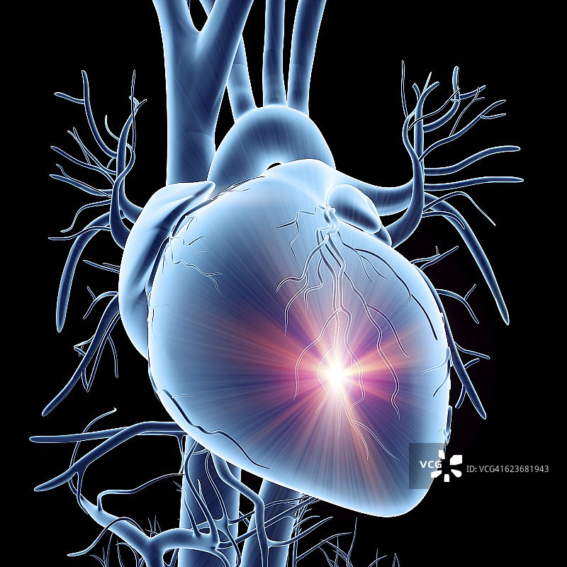 心脏病发作概念艺术作品图片素材