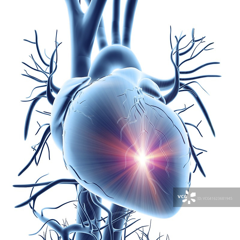 心脏病发作概念艺术作品图片素材
