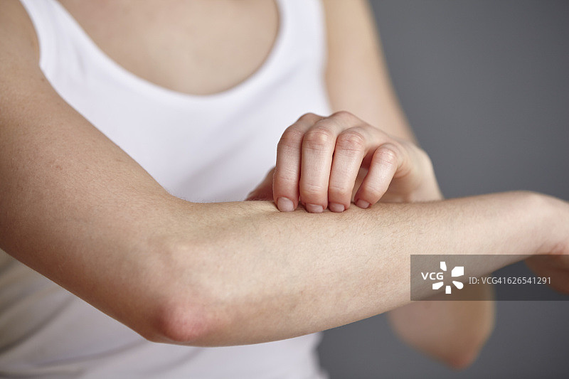 年轻女子用手指挠前臂的局部照片图片素材