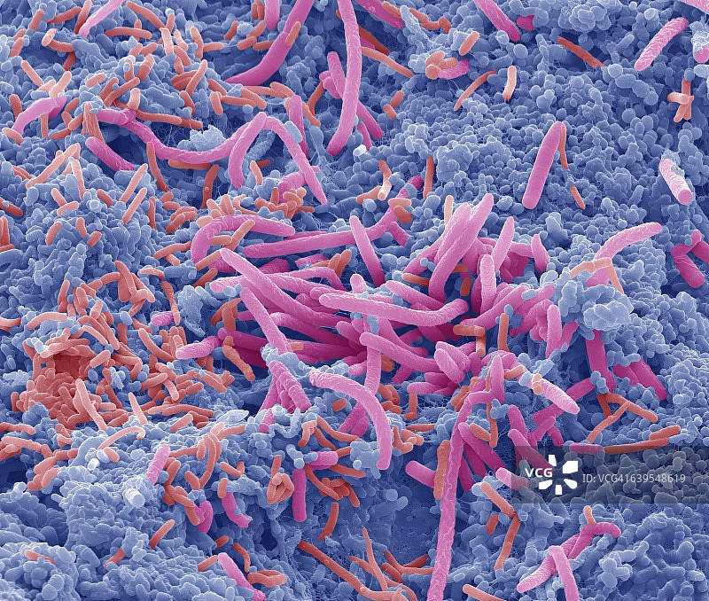 舌头细菌，扫描电子显微镜图图片素材