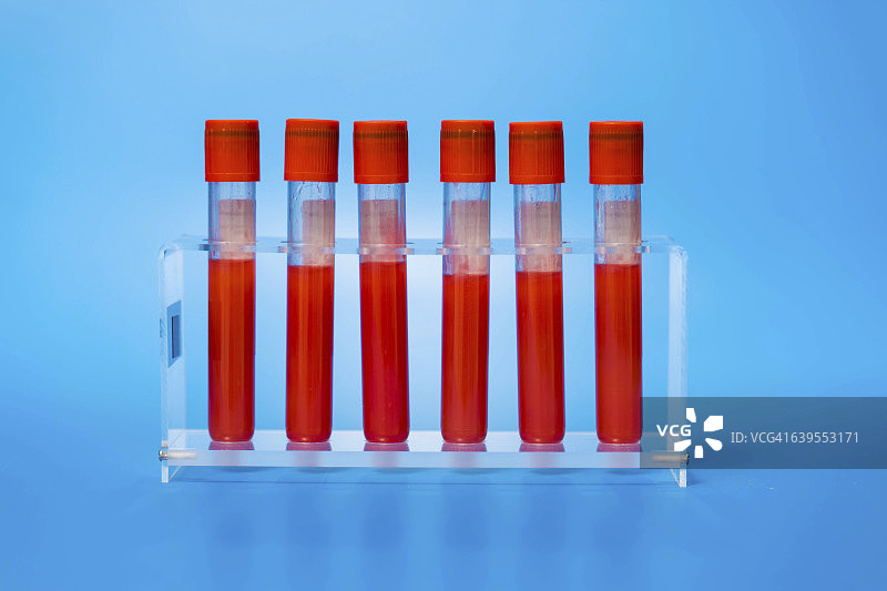试管中的血样图片素材