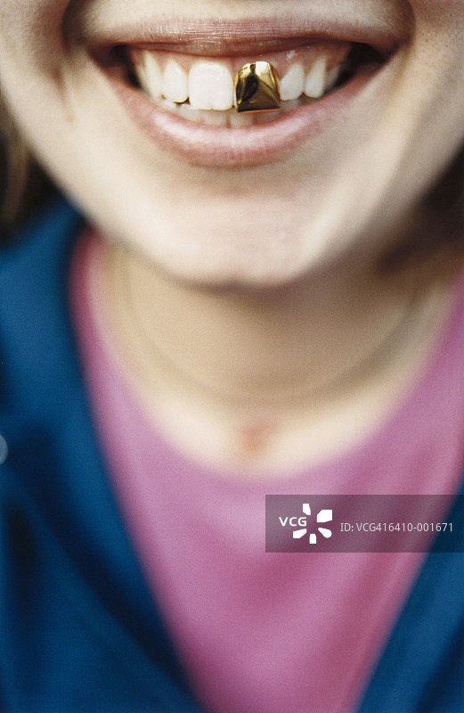 戴着金牙冠的女人图片素材
