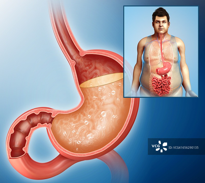 人类胃酸图解图片素材
