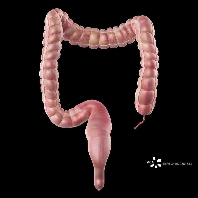 人体大肠图片素材