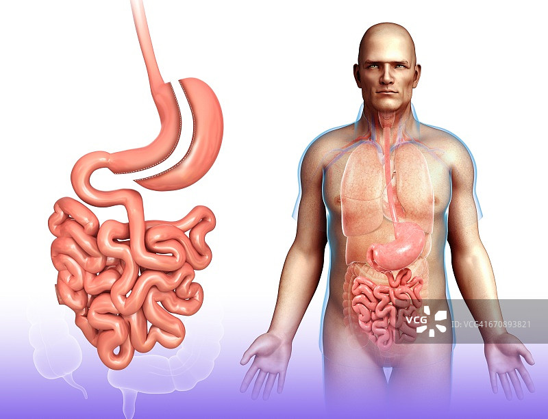 袖状胃切除术插图图片素材