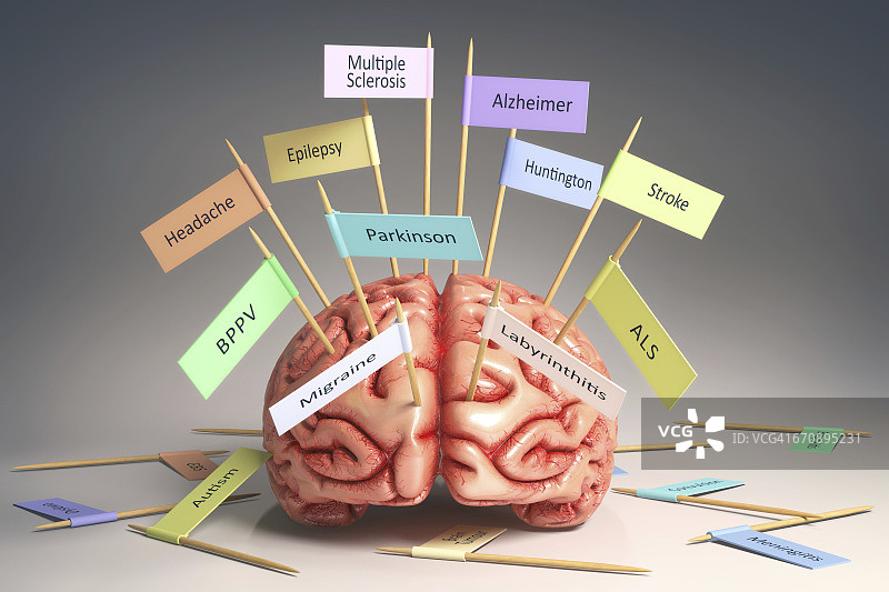 具有医疗状况的人脑图片素材
