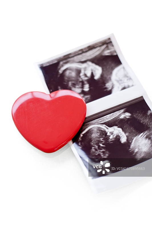 婴儿扫描照片和红心图片素材
