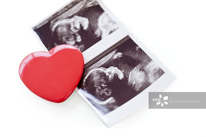 婴儿扫描照片和红心图片素材