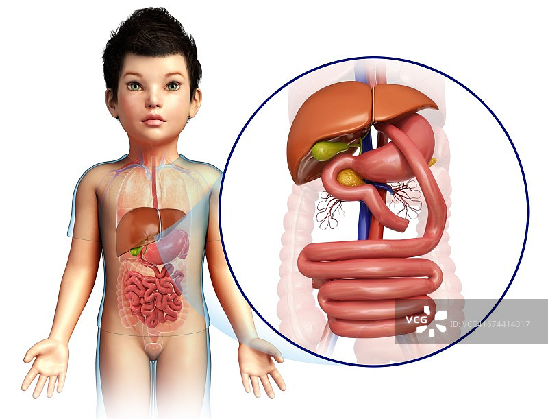 儿童胃旁路手术插图图片素材