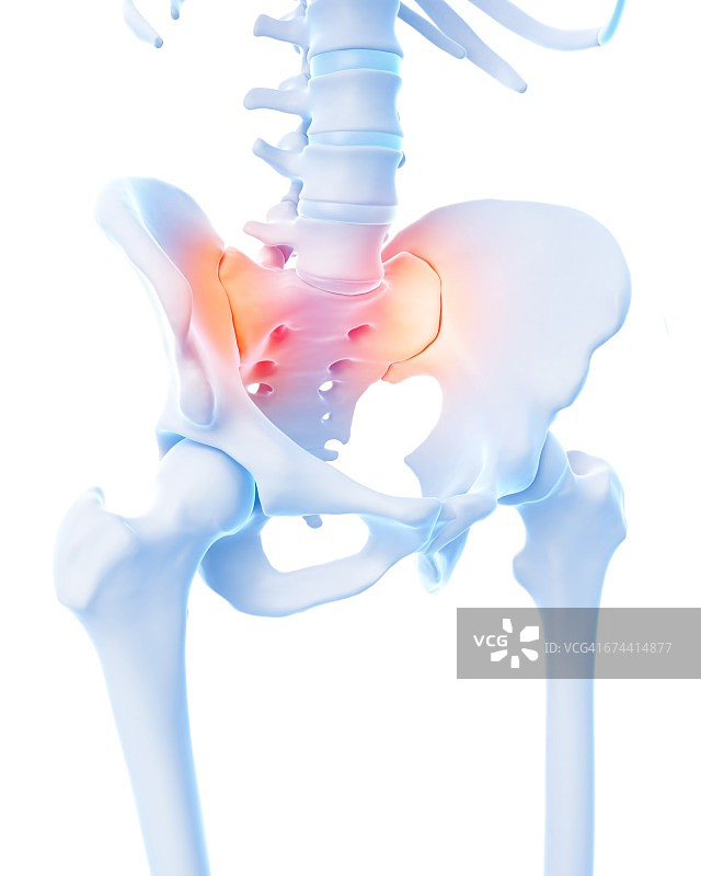 人的髋部疼痛图片素材
