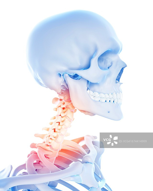 颈部疼痛图片素材