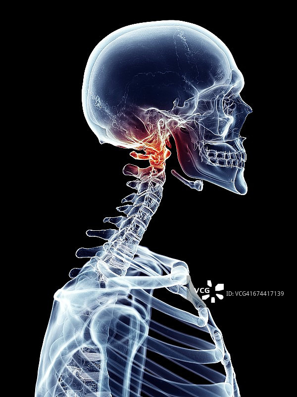 颈部疼痛图片素材