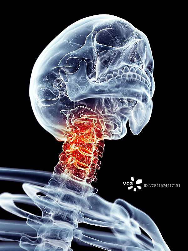 颈部疼痛图片素材