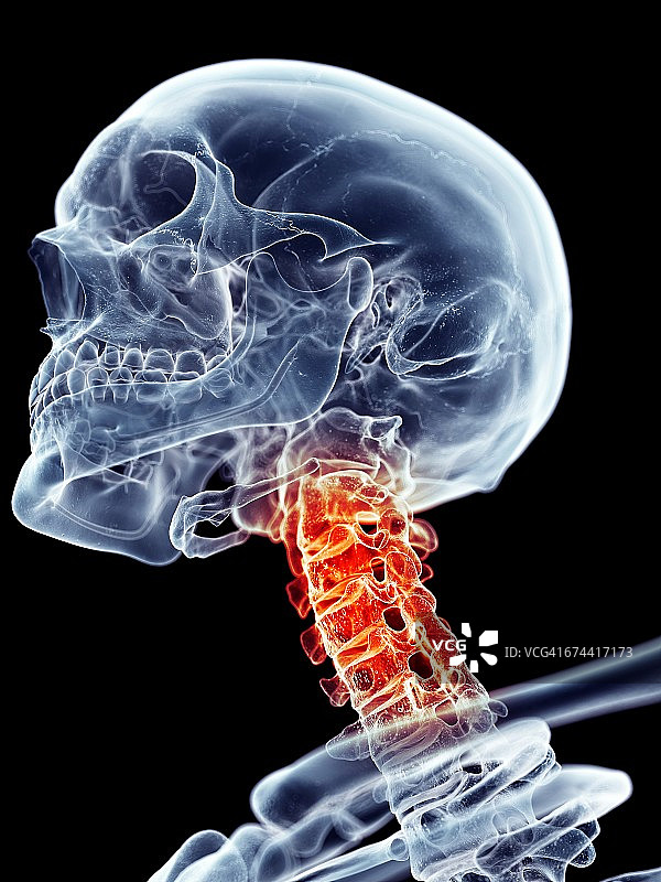 颈部疼痛图片素材