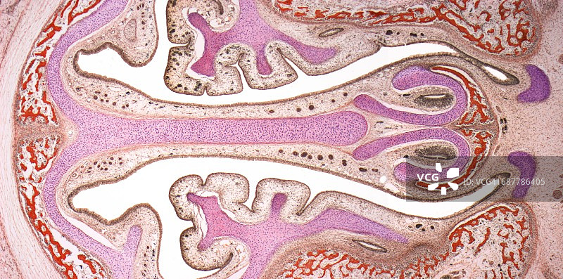 鼻窦，LM图片素材