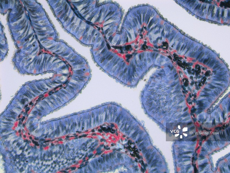 输卵管，LM图片素材