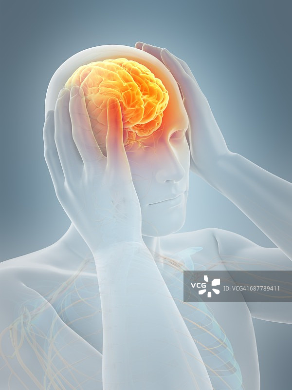 头痛患者解剖图图片素材