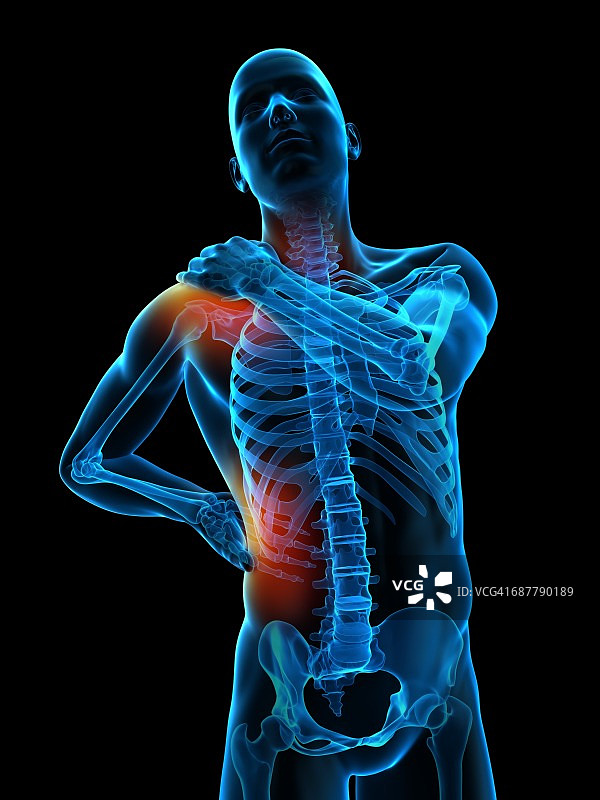 肩部和腰部疼痛插图图片素材