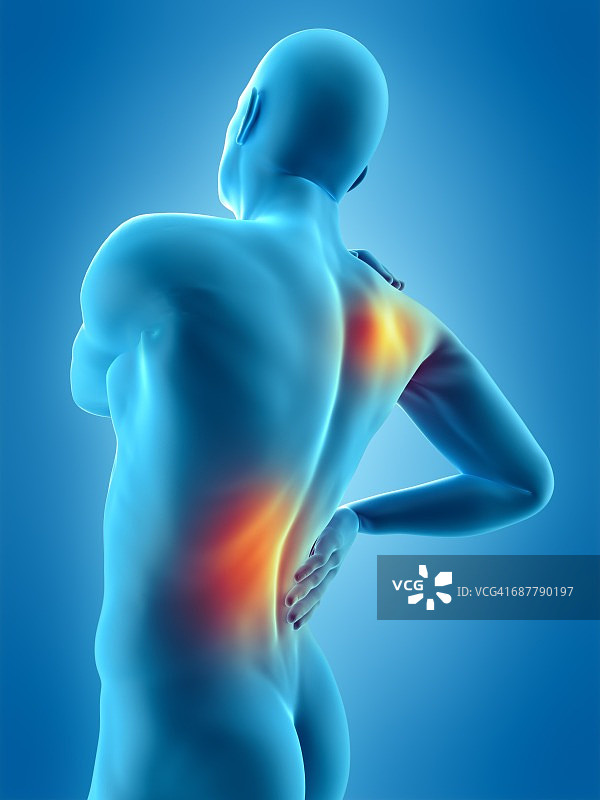 人类肩部和腰部疼痛插图图片素材