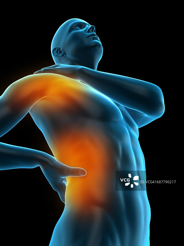 人类肩部和腰部疼痛插图图片素材