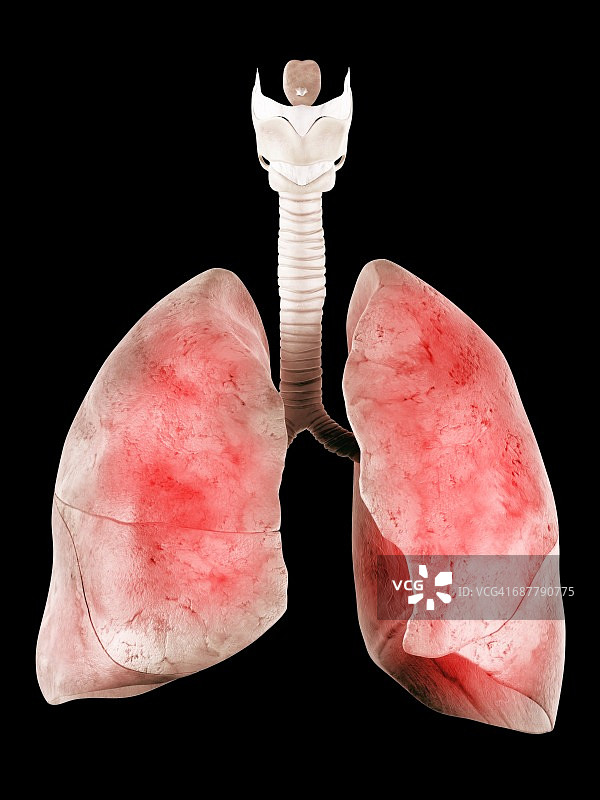 人类肺部插图图片素材