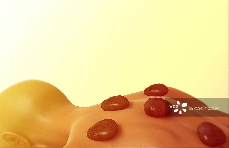 女士背部热石图片素材