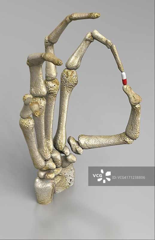 带有药丸的骷髅手景色图片素材