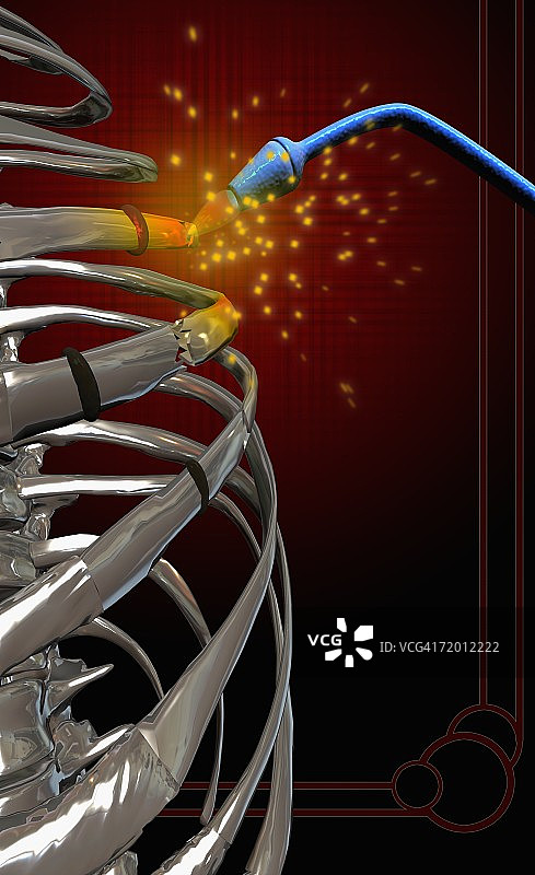 焊接人体骨骼的焊枪特写图片素材