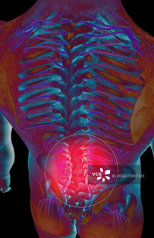 背部疼痛图片素材