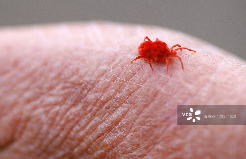 人皮肤上的天鹅绒螨虫特写图片素材