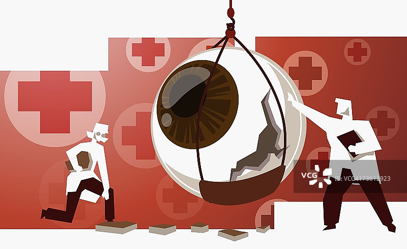 男医生和女医生检查受损的眼球图片素材