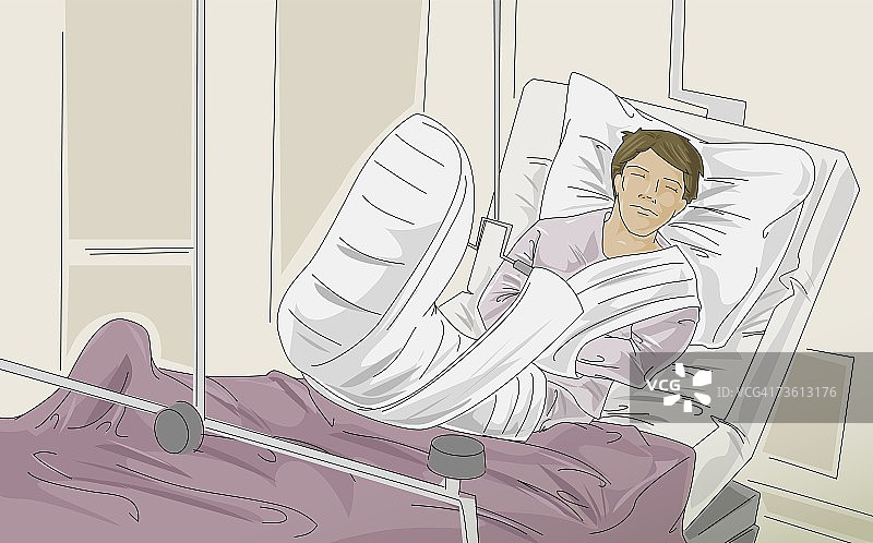 腿部骨折躺在病床上的男病人图片素材