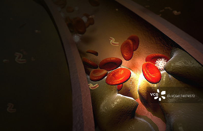 血凝块图片素材