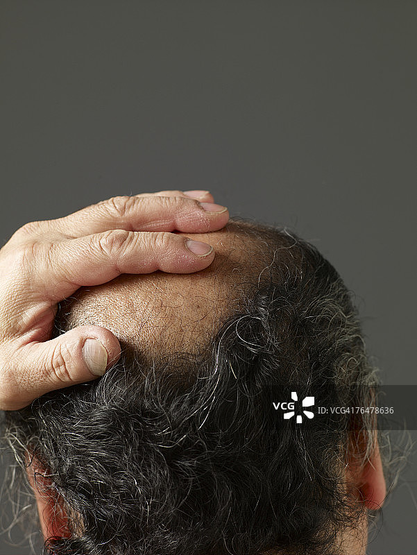 成熟男人摸着秃顶的头，后视图特写图片素材