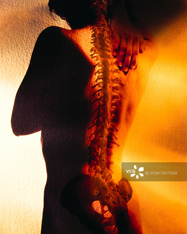 背痛的人图片素材