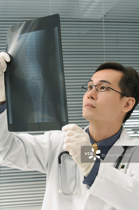 医生检查膝盖X光片图片素材
