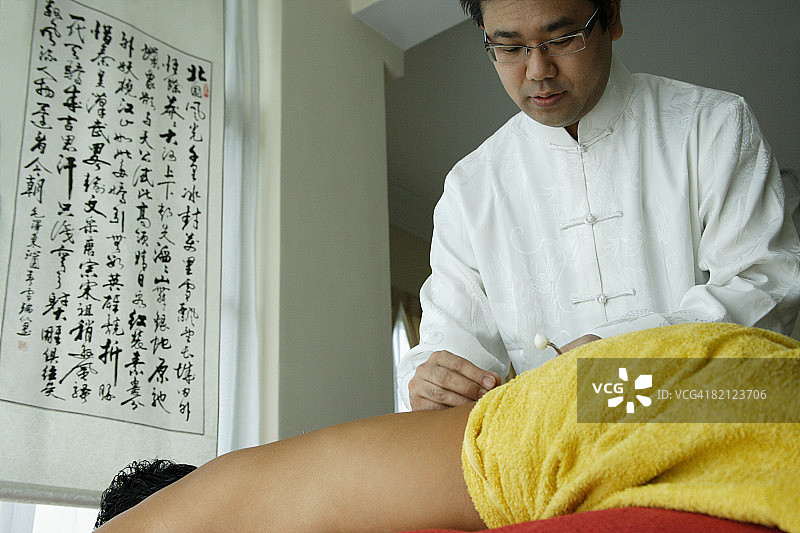 中年男人接受针灸治疗图片素材