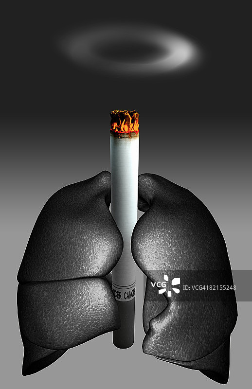肺癌图片素材