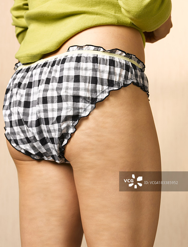 患有蜂窝组织的女人图片素材