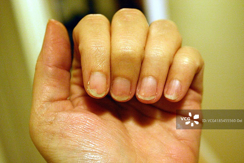 手指甲图片素材